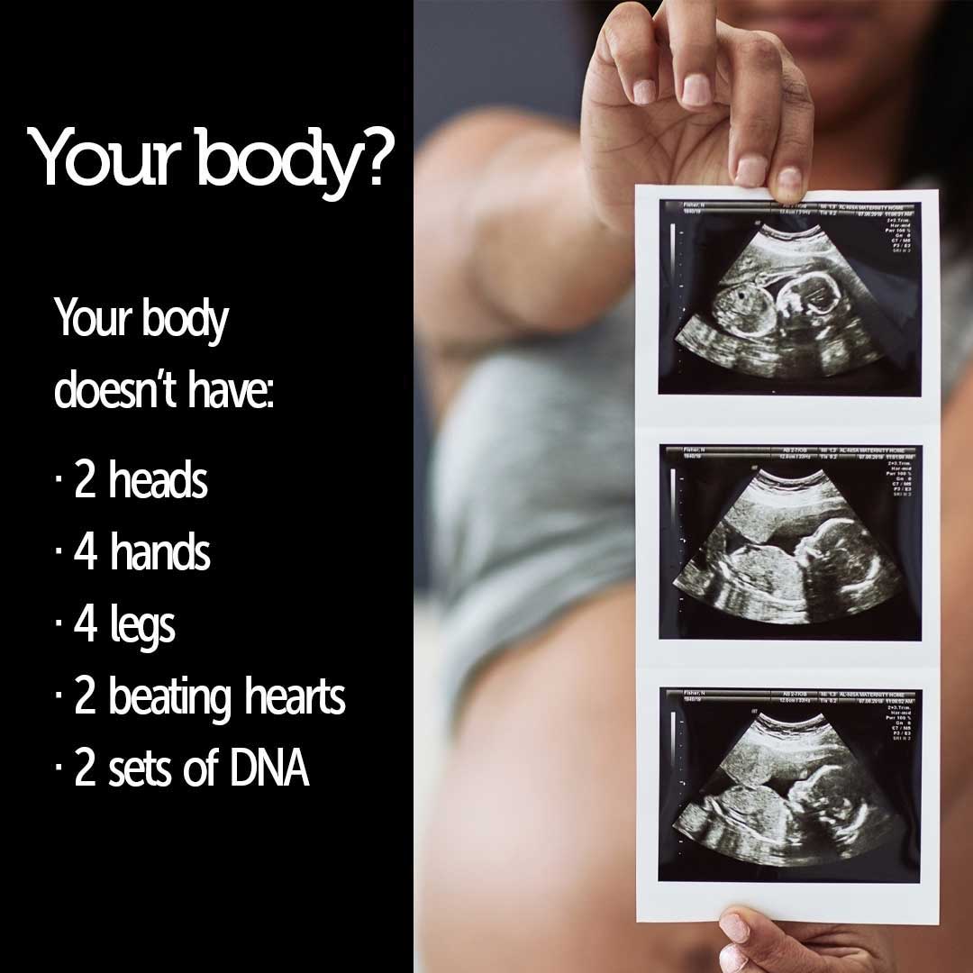 prolife_meme_reformed_perspective_1